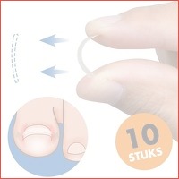 Behandelstrips ingegroeide teennagels