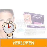 GlamWhite Elite tandenbleekset