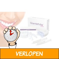 Tandenbleekset GlamWhite